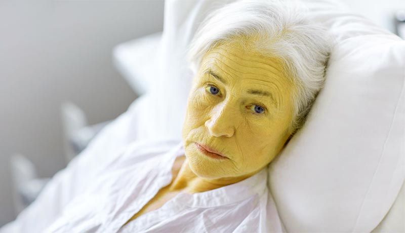 La-piel-amarilla-no-siempre-es-hepatitis - Higado Sano