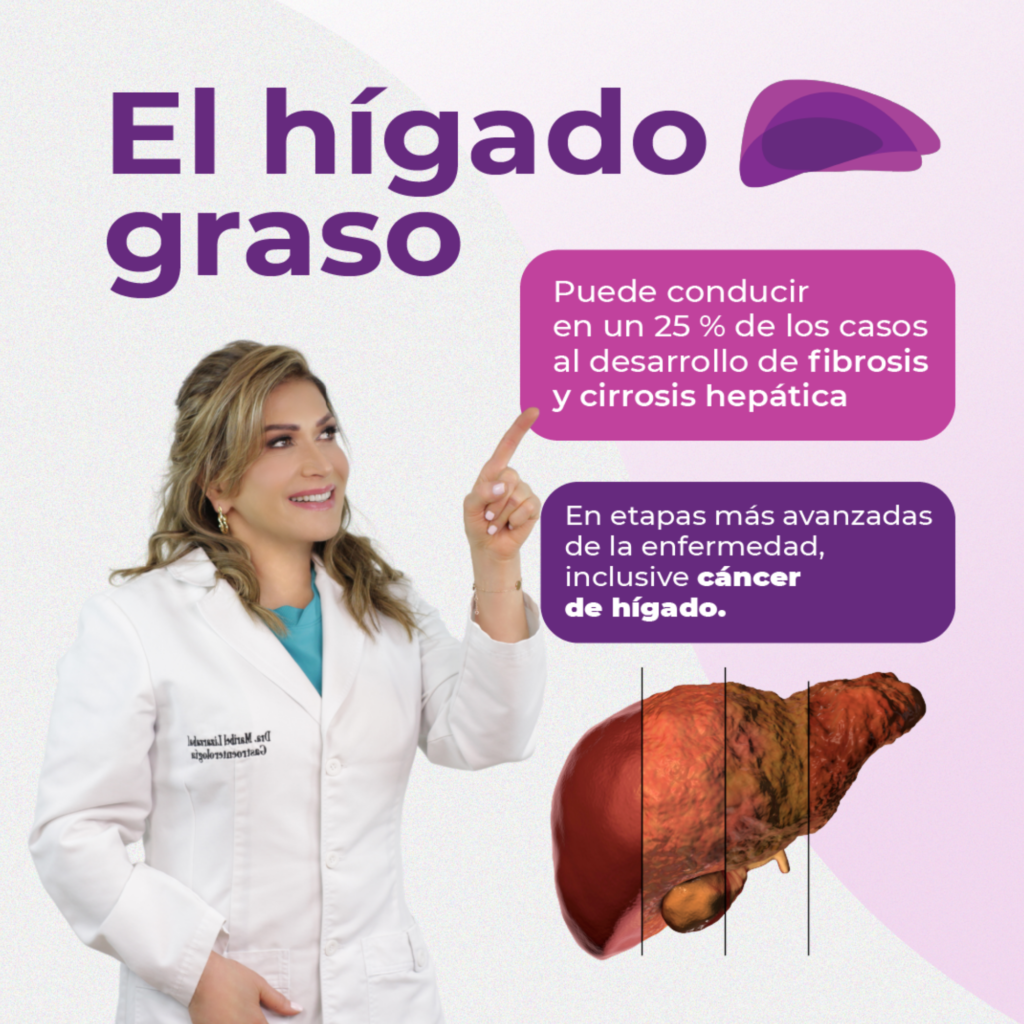 Hígado graso y transplante