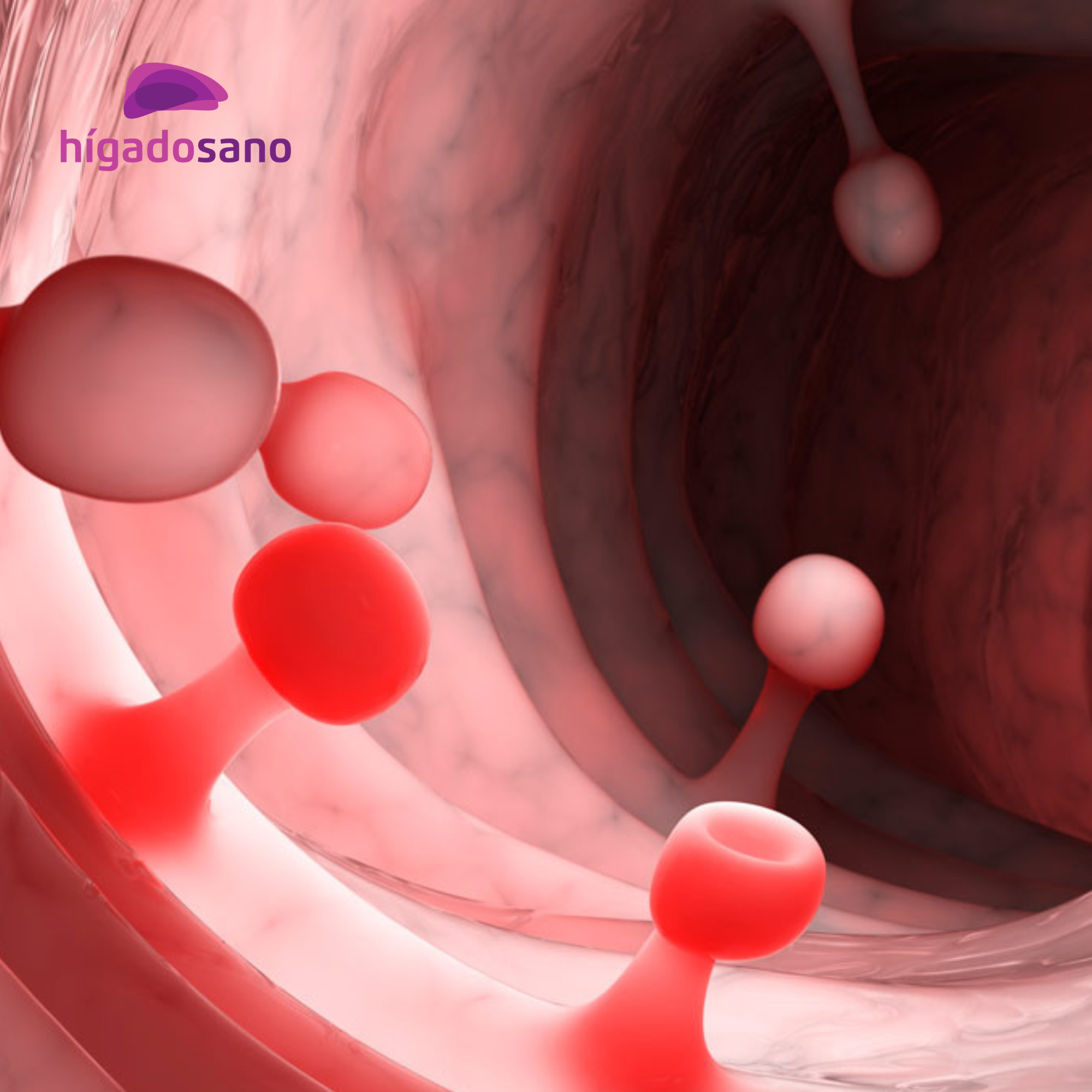 pólipos cáncer colorrectal