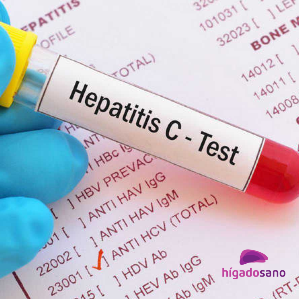 Prueba de hepatitis C Higado Sano